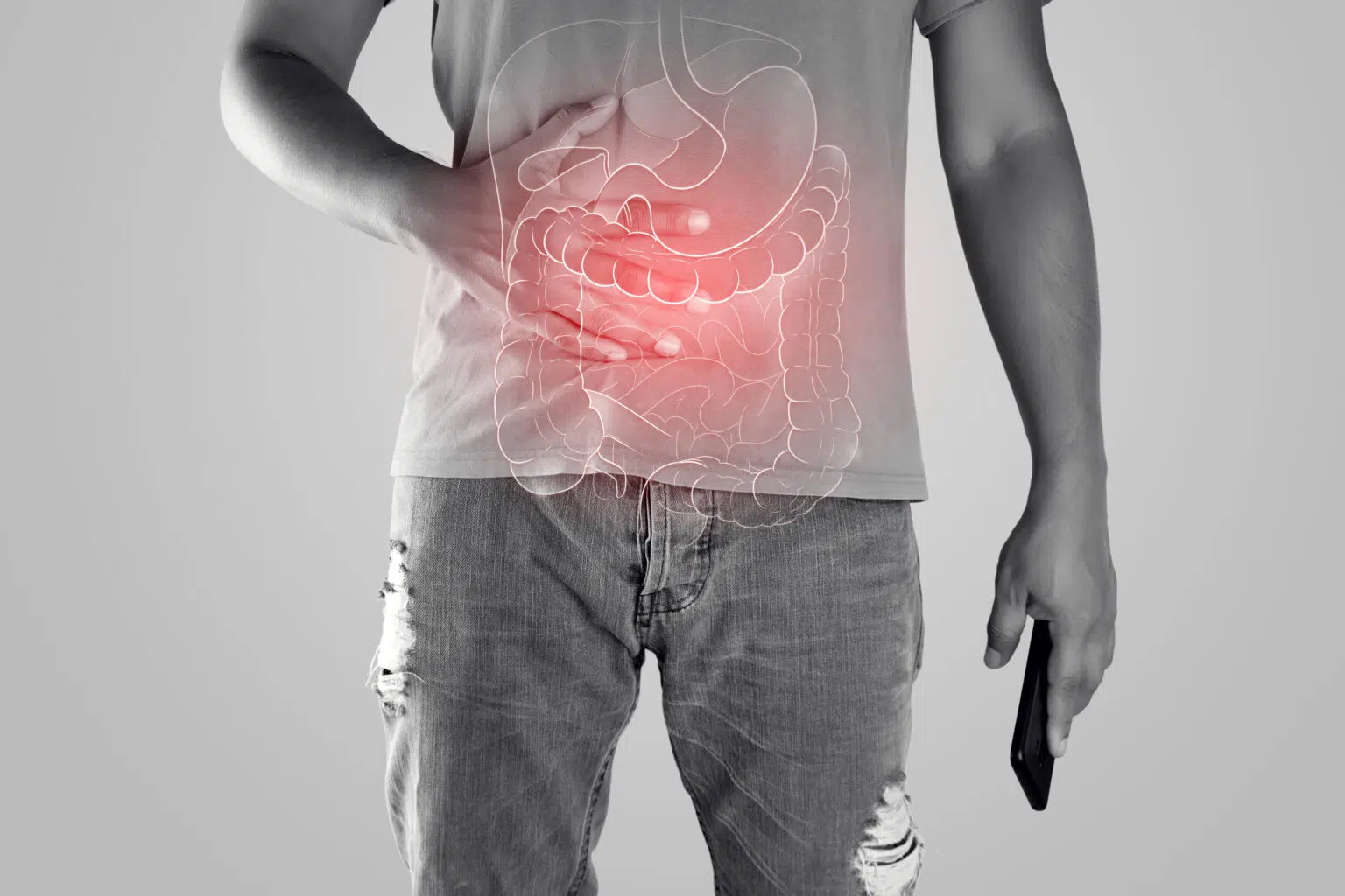 Maladie de Crohn