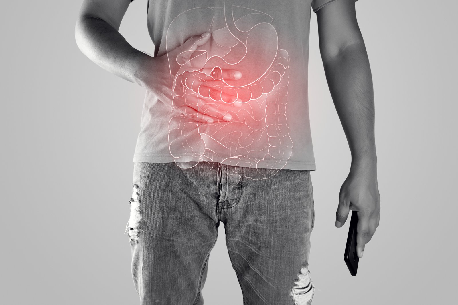 Maladie de Crohn