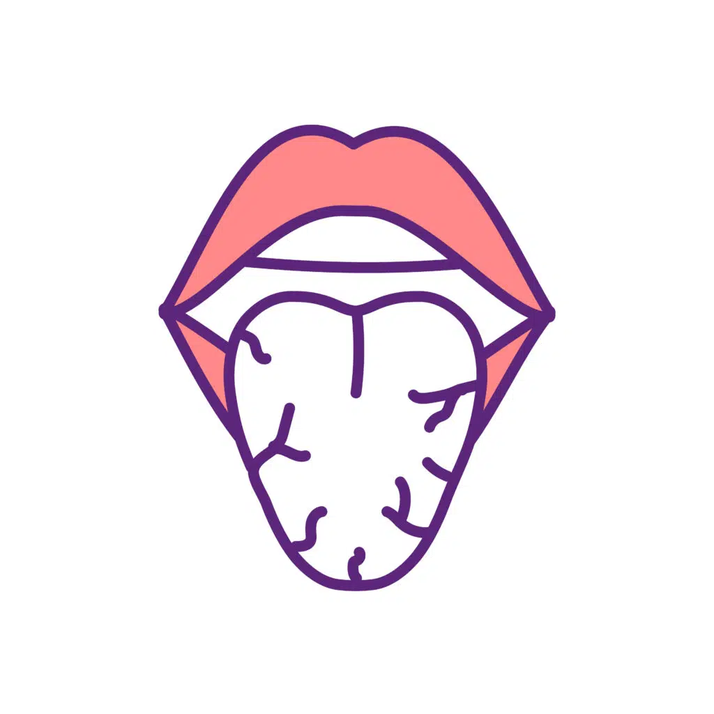 bouche sèche