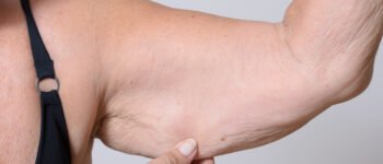 Masse musculaire et âge : préserver sa force à tout âge