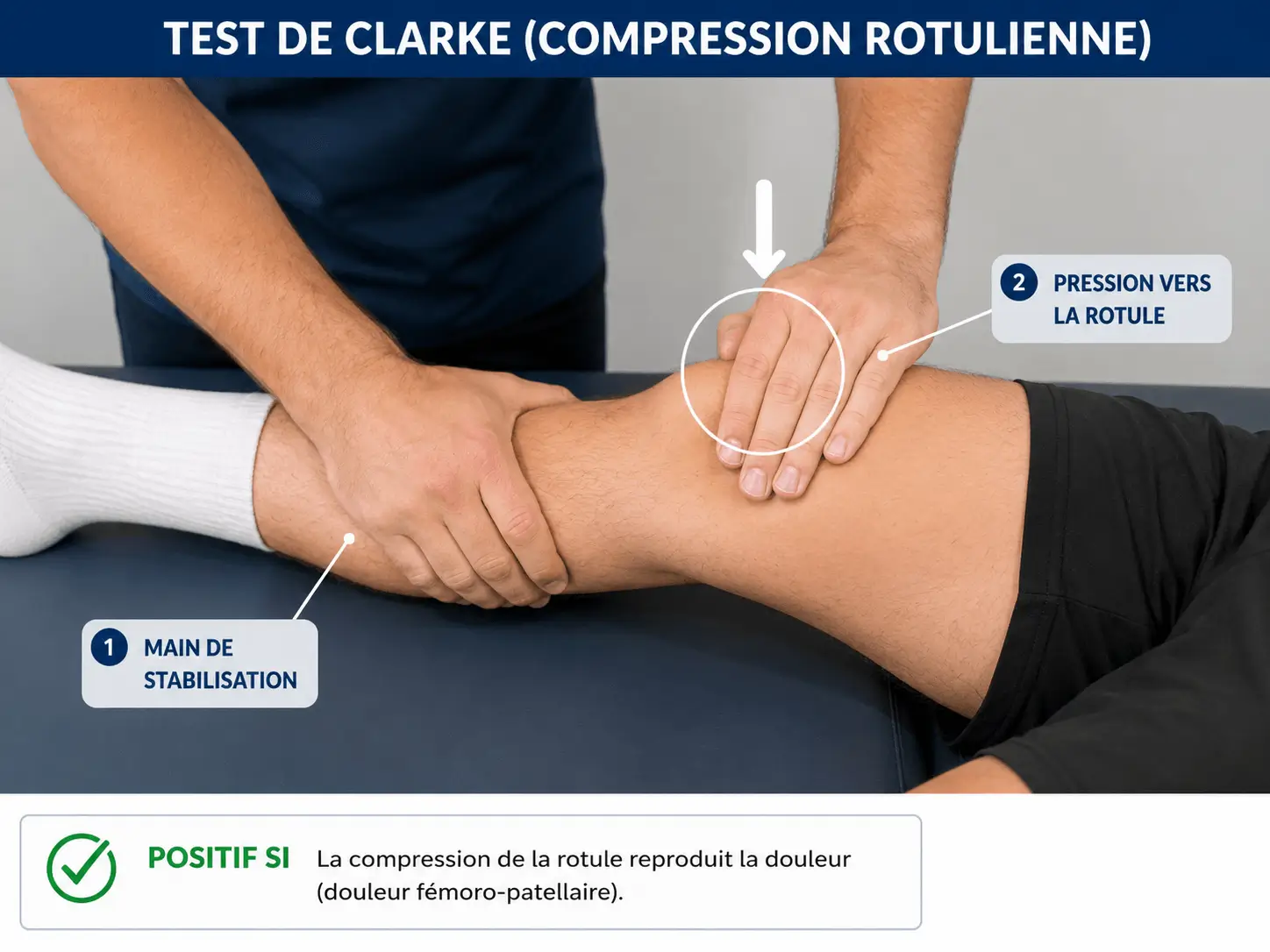 Position correcte des mains pour réaliser le test de Clarke ou compression rotulienne