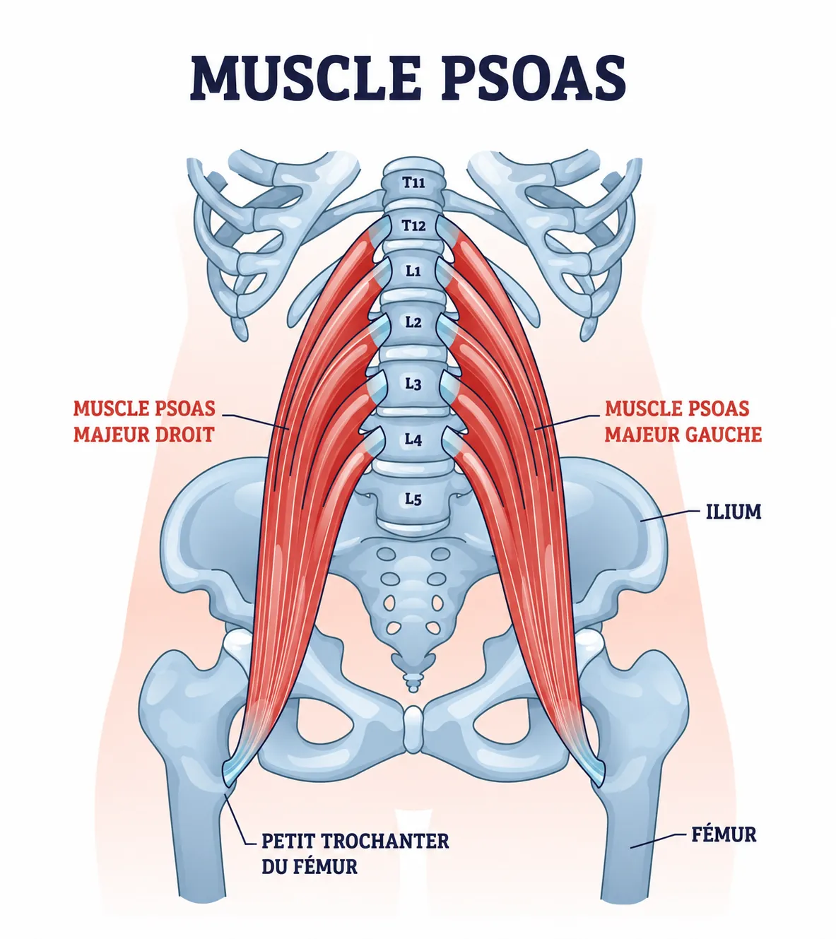 Anatomie du muscle ilio-psoas : le psoas major nait des vert&egrave;bres lombaires, l'iliaque tapisse l'int&eacute;rieur du bassin, les deux se rejoignent pour s'ins&eacute;rer sur le petit trochanter du f&eacute;mur