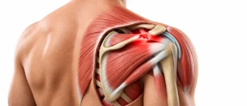 Coiffe des rotateurs : tendinopathie, symptômes et exercices