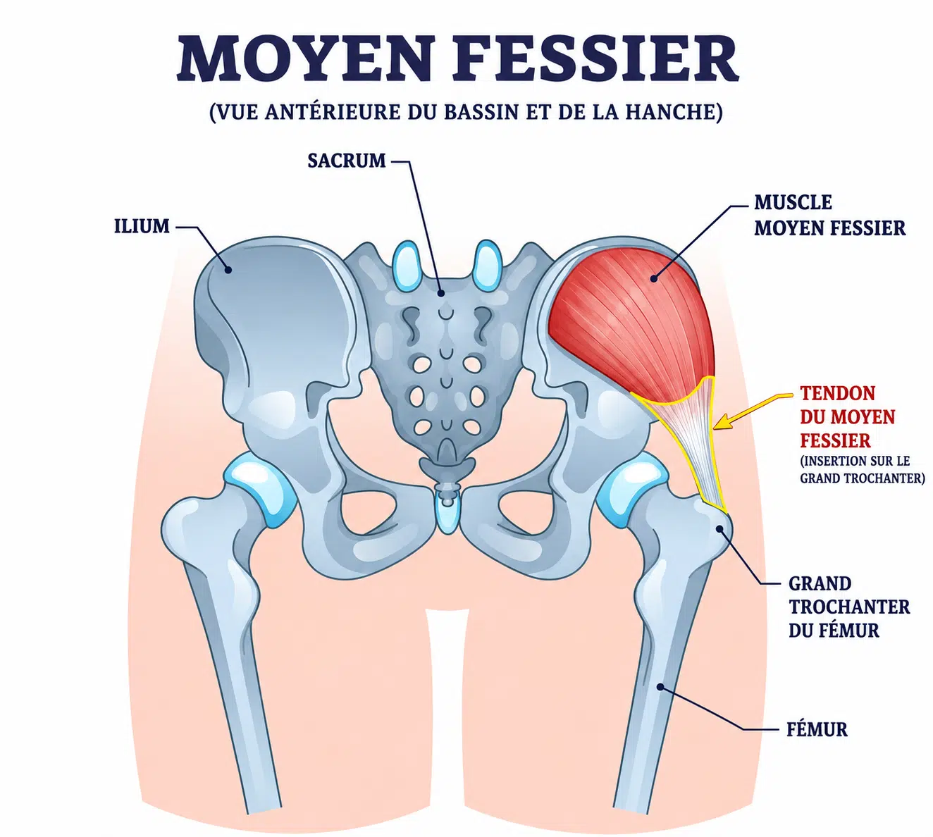 Tendinite du moyen fessier : causes, symptômes, traitement 2 Anatomie du tendon du moyen fessier s'insérant sur le grand trochanter de la hanche
