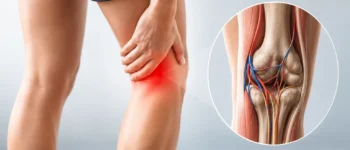 Douleur derrière le genou : causes, traitements et exercices pour récupérer